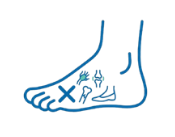 forefoot causes